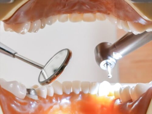 歯,治療